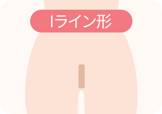 Iライン形